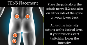 A picture showing where to place Tens Machine electrodes to treat sciatica 